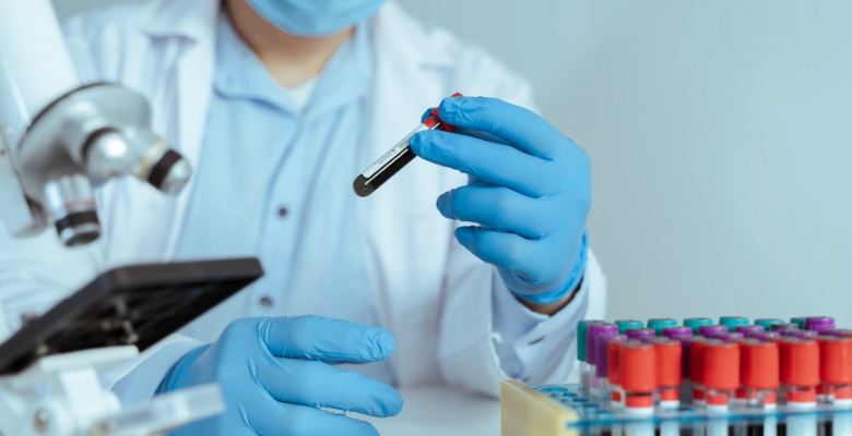 Trombocitopenia afeta até 15% dos doentes com síndrome antifosfolipídica